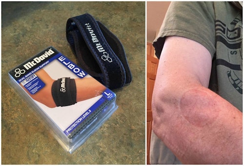 The author relies on a McDavid Dual Band Elbow Support. After removing the strap, the skin stamp is easy to see.